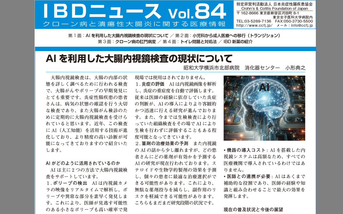 IBDニュース